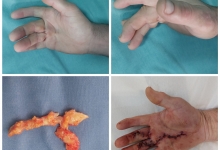 Laborator Analize Mioveni Analize Medicale Mioveni - Clinica Dr. Gupta